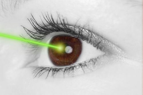New York Times Lasik Story: Is a Lasik Success?